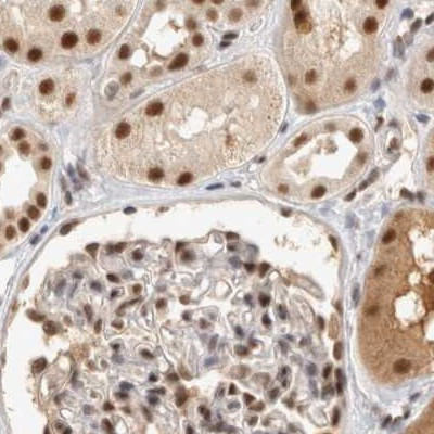 ZNF830 Antibody in Immunohistochemistry (IHC)