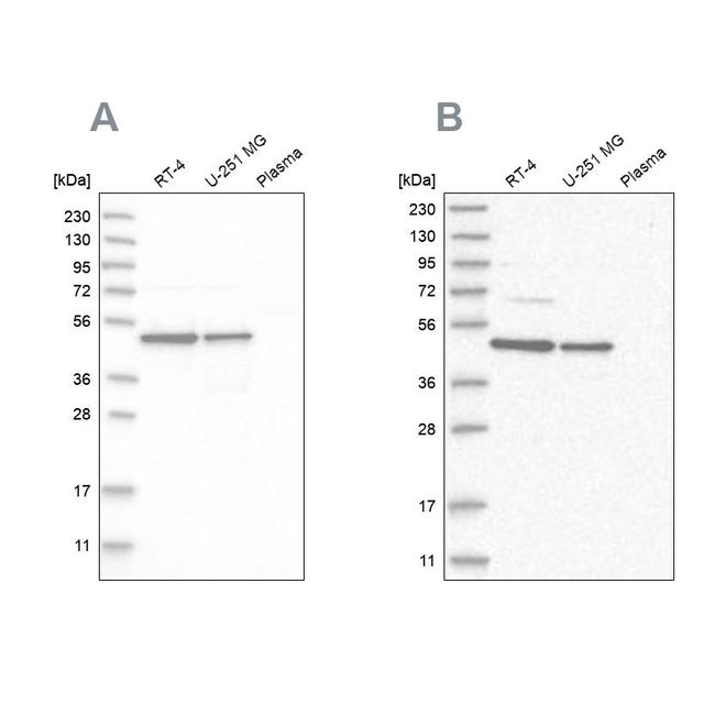 ZNF830 Antibody in Western Blot (WB)