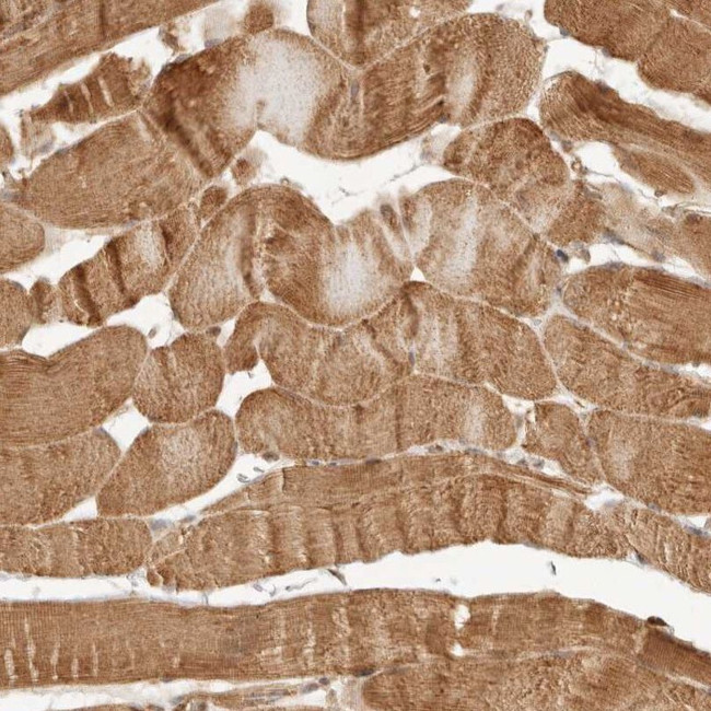 KLHL38 Antibody in Immunohistochemistry (IHC)