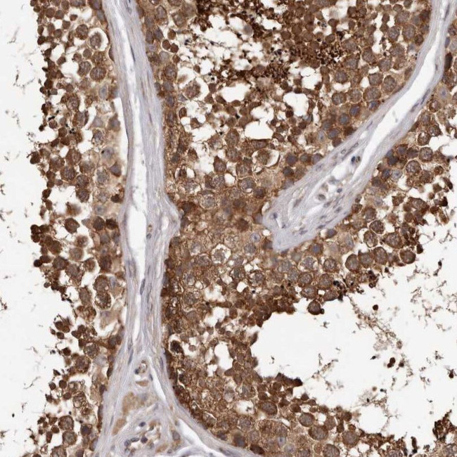 VPS37A Antibody in Immunohistochemistry (IHC)