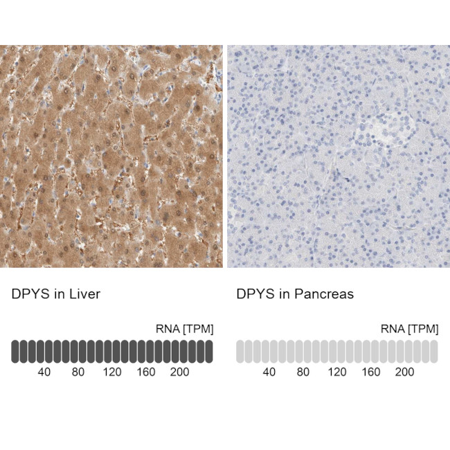 DPYS Antibody in Immunohistochemistry (IHC)