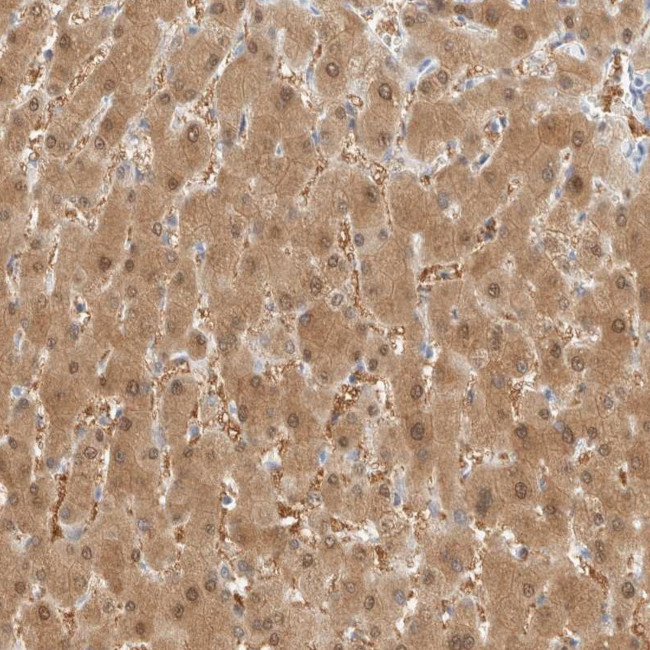 DPYS Antibody in Immunohistochemistry (IHC)