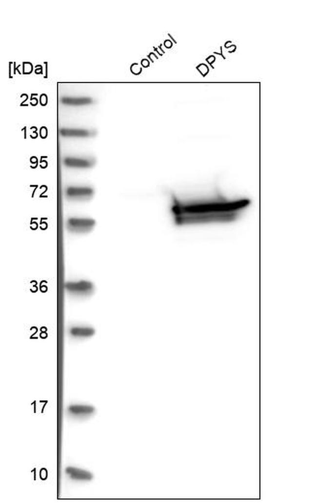 DPYS Antibody in Western Blot (WB)