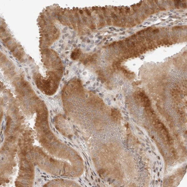 GEM Antibody in Immunohistochemistry (IHC)