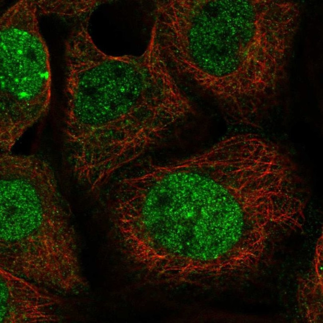 LETM2 Antibody in Immunocytochemistry (ICC/IF)