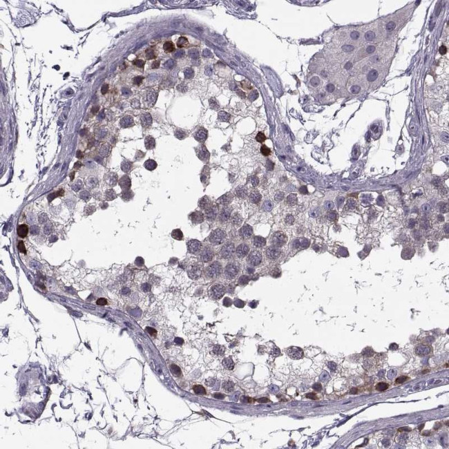 LETM2 Antibody in Immunohistochemistry (IHC)