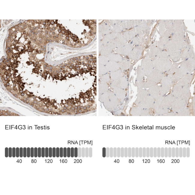 eIF4G3 Antibody in Immunohistochemistry (IHC)