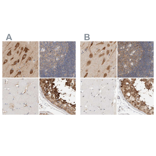 eIF4G3 Antibody in Immunohistochemistry (IHC)