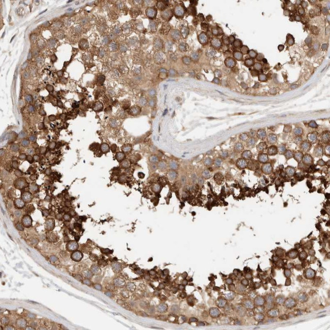 eIF4G3 Antibody in Immunohistochemistry (IHC)