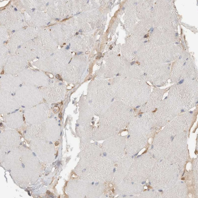 eIF4G3 Antibody in Immunohistochemistry (IHC)