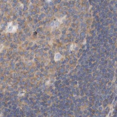 eIF4G3 Antibody in Immunohistochemistry (IHC)