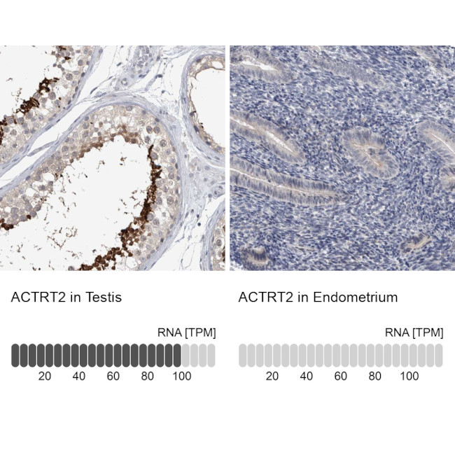 ACTRT2 Antibody in Immunohistochemistry (IHC)