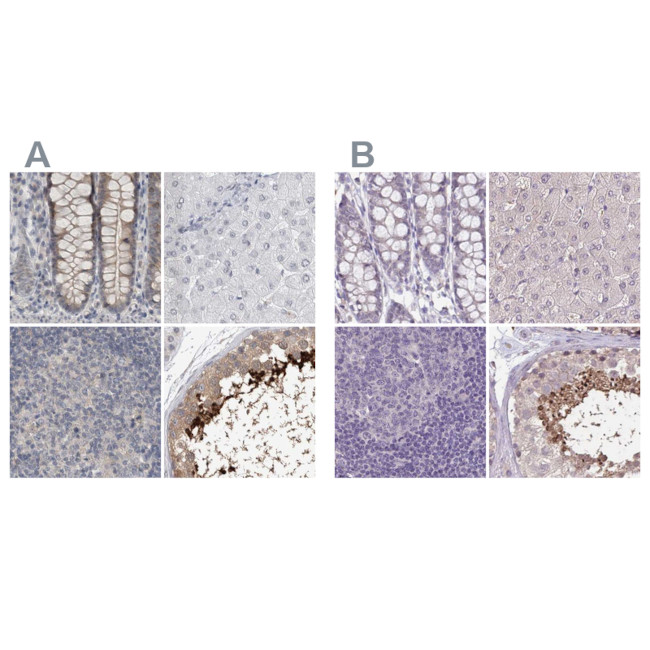 ACTRT2 Antibody in Immunohistochemistry (IHC)