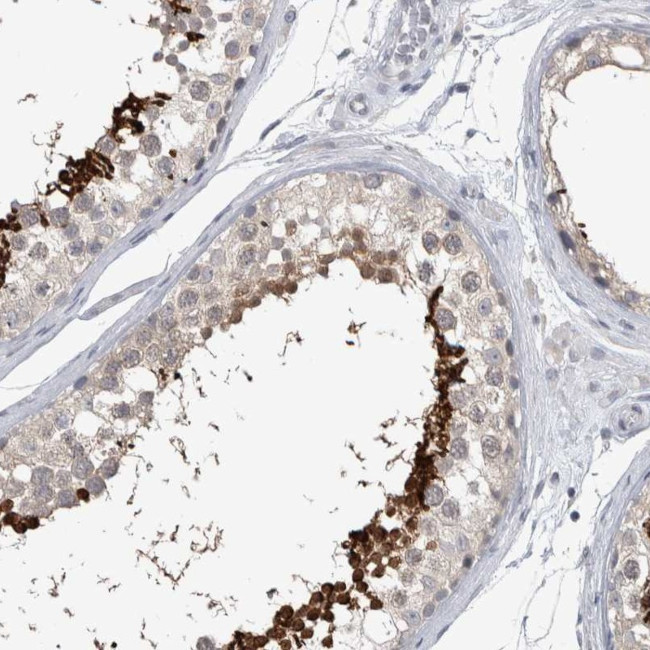 ACTRT2 Antibody in Immunohistochemistry (IHC)