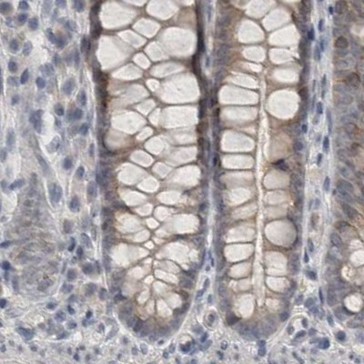 ACTRT2 Antibody in Immunohistochemistry (IHC)