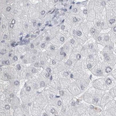 ACTRT2 Antibody in Immunohistochemistry (IHC)