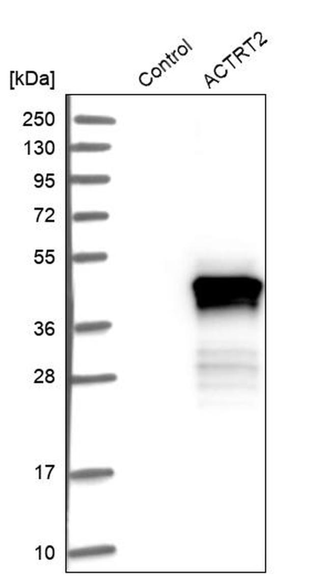 ACTRT2 Antibody in Western Blot (WB)