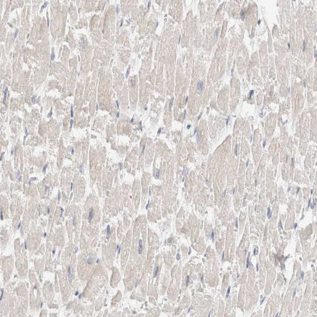 SDR16C5 Antibody in Immunohistochemistry (IHC)