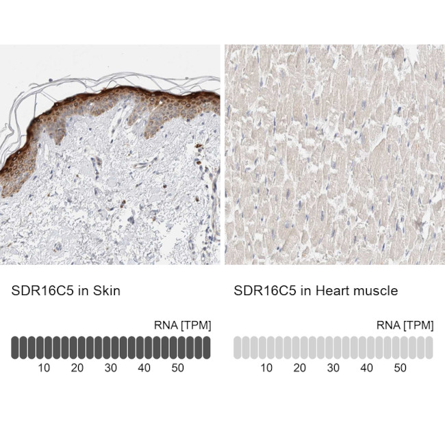 SDR16C5 Antibody