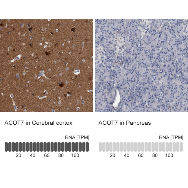 ACOT7 Antibody in Immunohistochemistry (IHC)