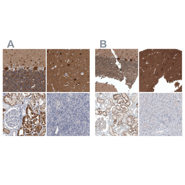 ACOT7 Antibody in Immunohistochemistry (IHC)