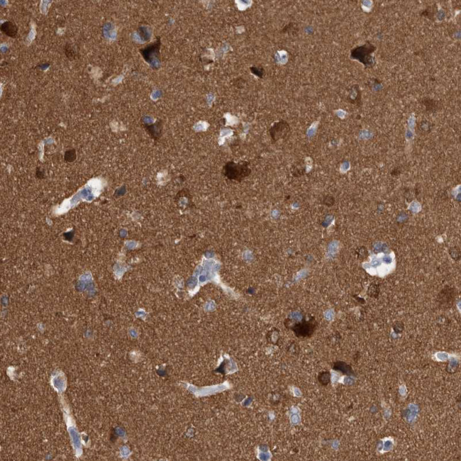 ACOT7 Antibody in Immunohistochemistry (IHC)