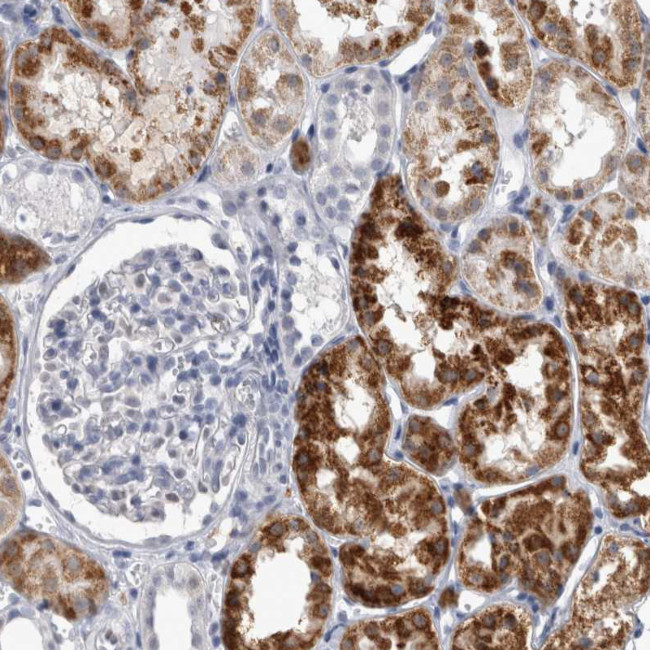 ACOT7 Antibody in Immunohistochemistry (IHC)