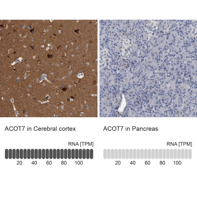 ACOT7 Antibody