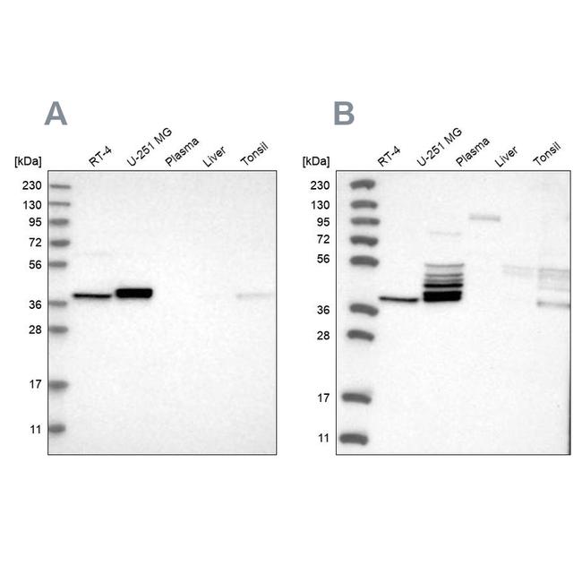 ACOT7 Antibody in Western Blot (WB)