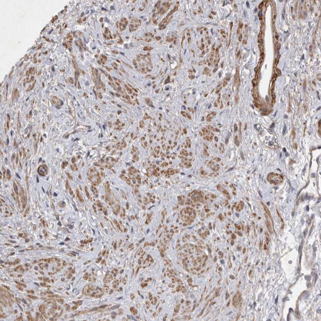 EDEM3 Antibody in Immunohistochemistry (IHC)