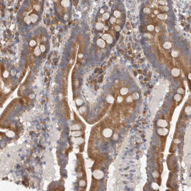 EDEM3 Antibody in Immunohistochemistry (IHC)