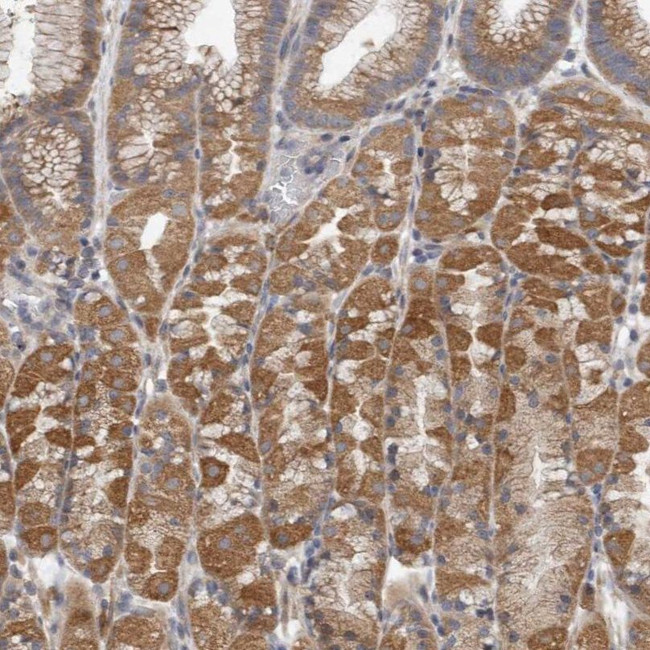 EDEM3 Antibody in Immunohistochemistry (IHC)