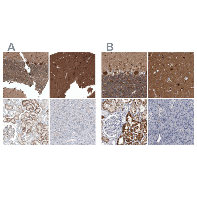 ACOT7 Antibody in Immunohistochemistry (IHC)