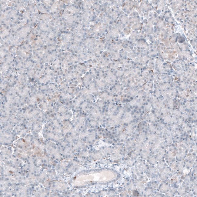 ACOT7 Antibody in Immunohistochemistry (IHC)