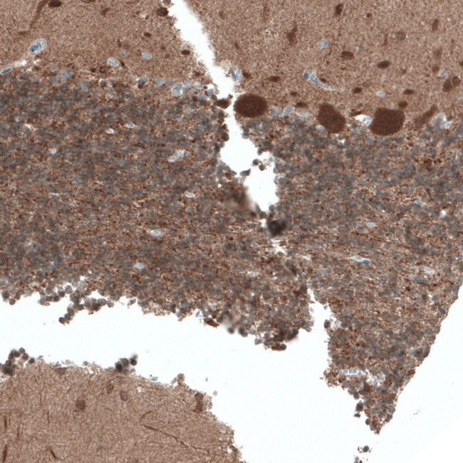 ACOT7 Antibody in Immunohistochemistry (IHC)