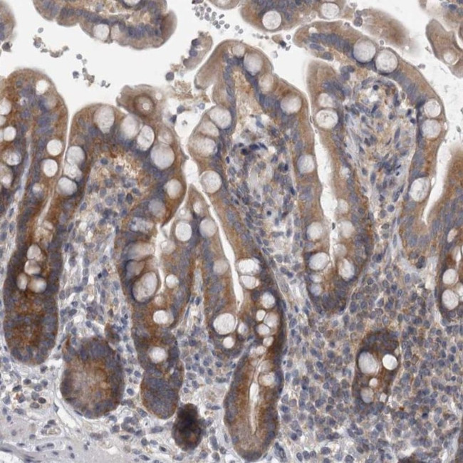 PRRC2C Antibody in Immunohistochemistry (IHC)