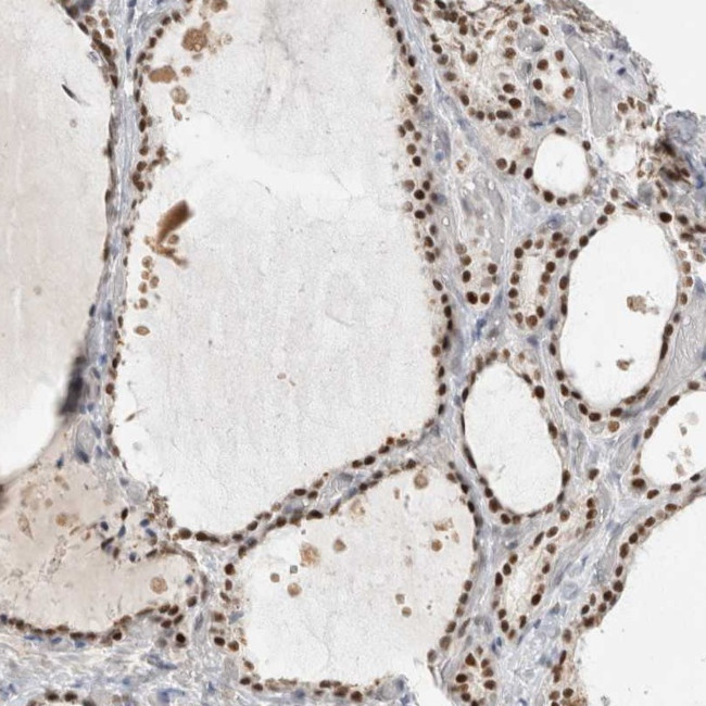 RECQ4 Antibody in Immunohistochemistry (IHC)