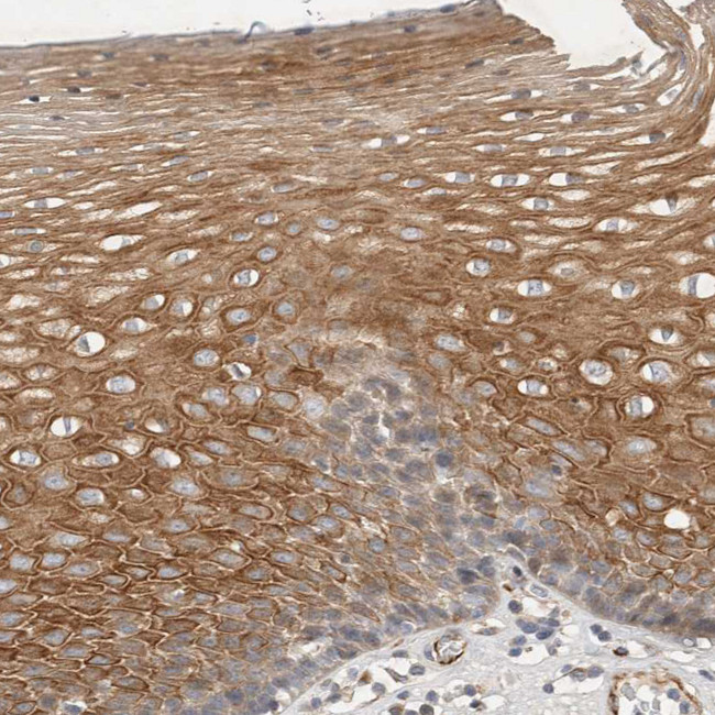 NMU Antibody in Immunohistochemistry (IHC)