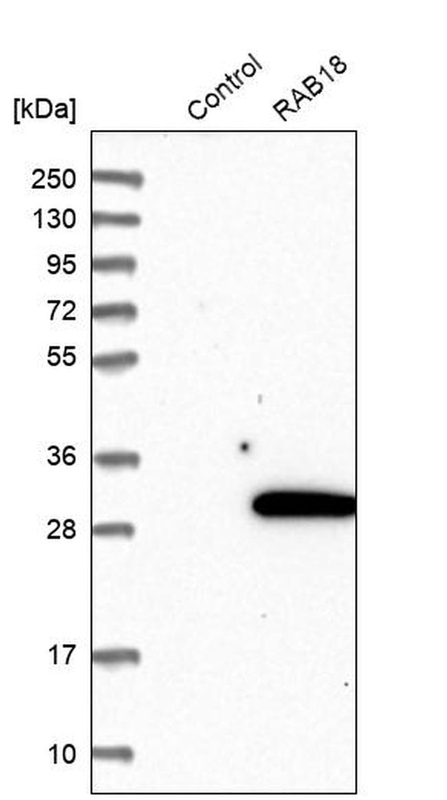 RAB18 Antibody in Western Blot (WB)