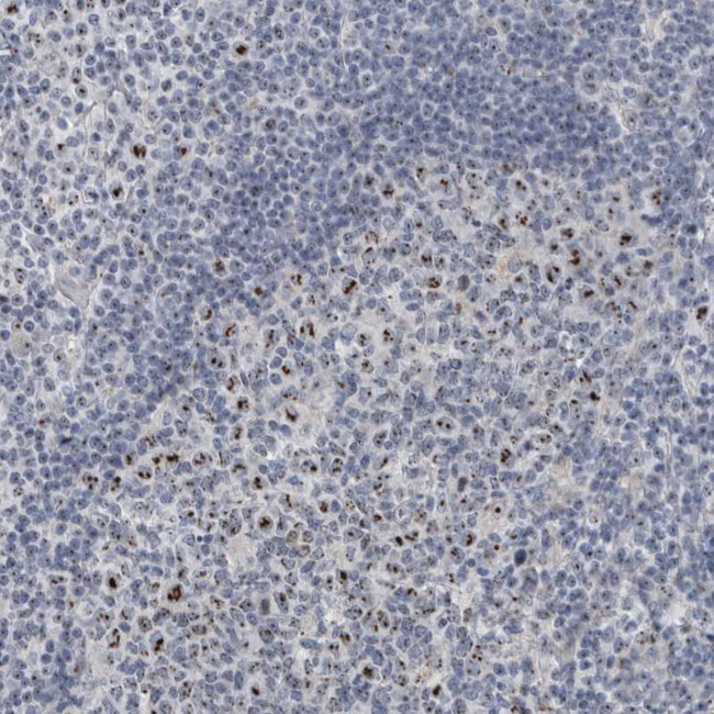 UTP6 Antibody in Immunohistochemistry (IHC)