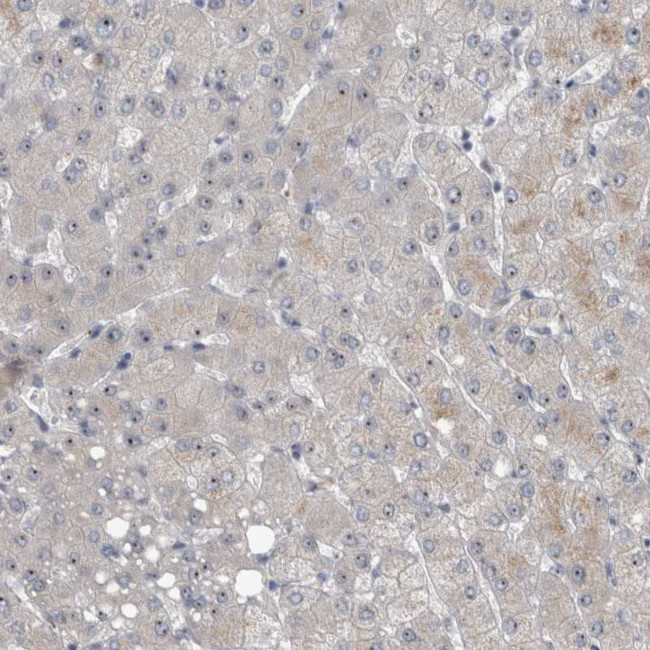 UTP6 Antibody in Immunohistochemistry (IHC)