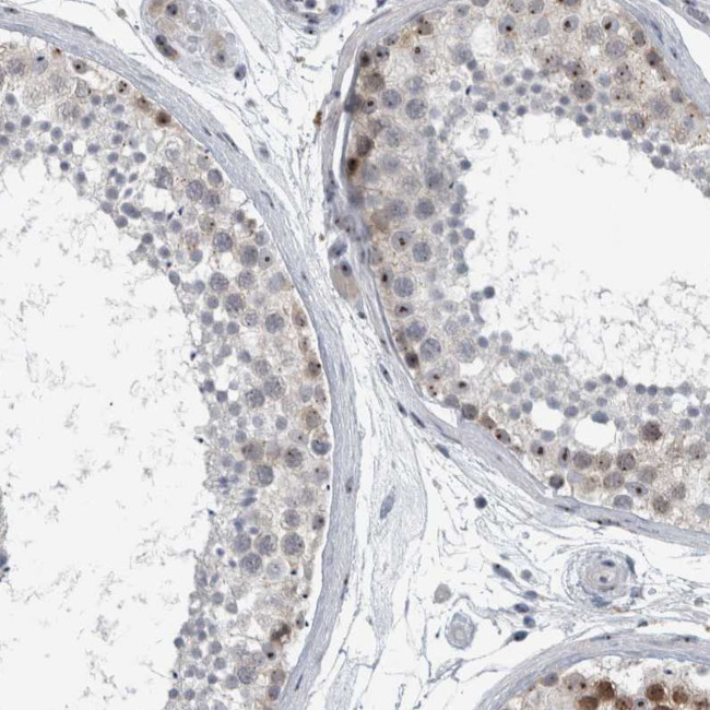 UTP6 Antibody in Immunohistochemistry (IHC)