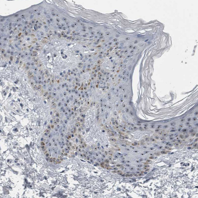 UTP6 Antibody in Immunohistochemistry (IHC)