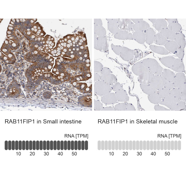 RAB11FIP1 Antibody in Immunohistochemistry (IHC)