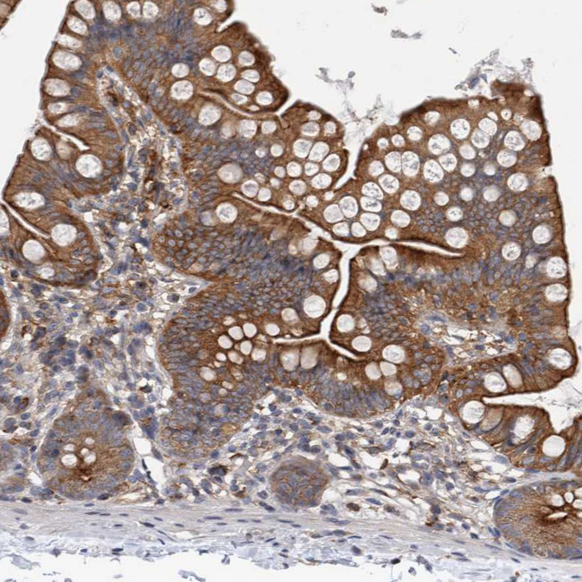 RAB11FIP1 Antibody in Immunohistochemistry (IHC)