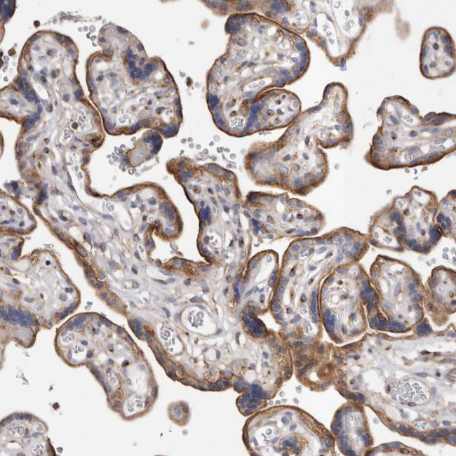 RAB11FIP1 Antibody in Immunohistochemistry (IHC)