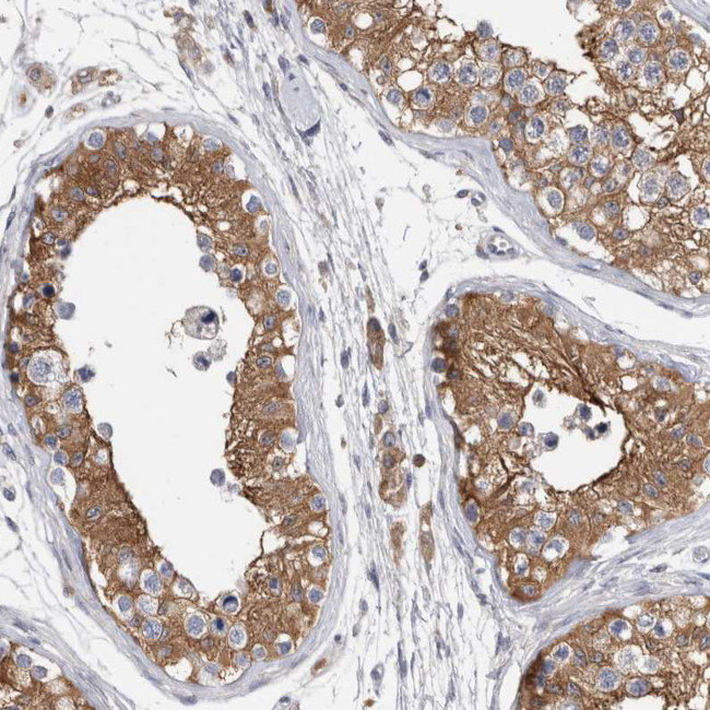 RAB11FIP1 Antibody in Immunohistochemistry (IHC)