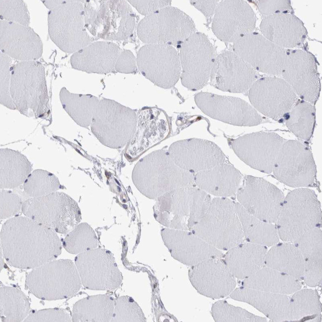 RAB11FIP1 Antibody in Immunohistochemistry (IHC)