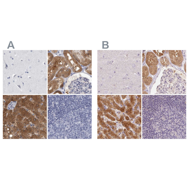 ALDH8A1 Antibody in Immunohistochemistry (IHC)