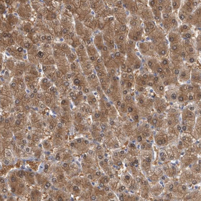 ALDH8A1 Antibody in Immunohistochemistry (IHC)